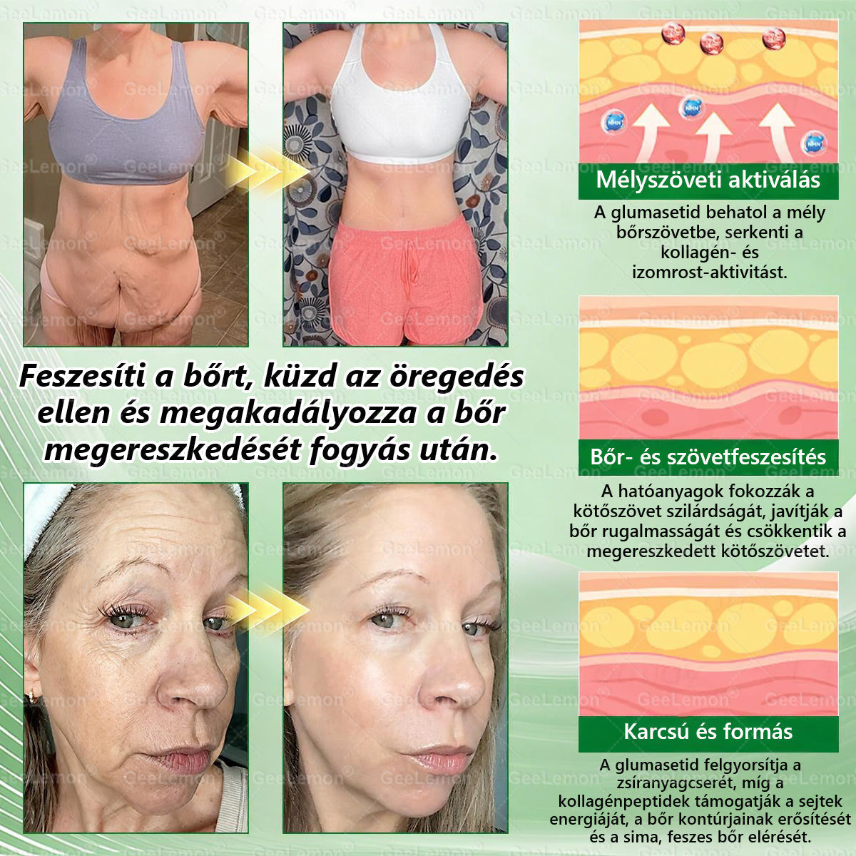 𝐆𝐞𝑒𝐿𝑒𝐦𝐨𝐧® Glumasetide 8 az 1-ben Karcsú és Egészséges Nano Mikrotűs Tapasz 🇭🇺