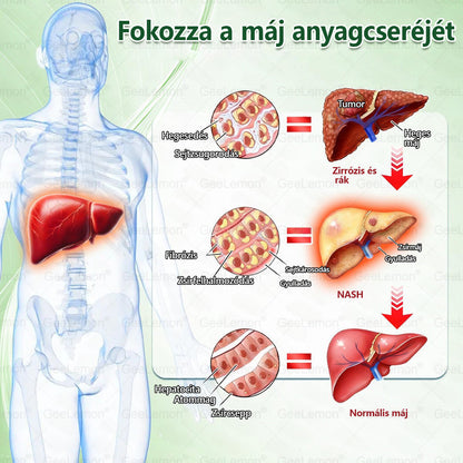 𝐆𝐞𝑒𝐿𝑒𝐦𝐨𝐧® Glumasetide 8 az 1-ben Karcsú és Egészséges Nano Mikrotűs Tapasz 🇭🇺
