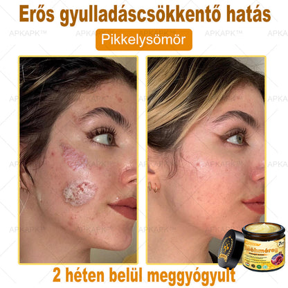 𝐀𝐏𝐊𝐀𝐏𝐊® 𝐌É𝐇𝐌É𝐑𝐄𝐆 Á𝐓𝐅𝐎𝐆Ó 𝐊𝐑É𝐌🥇𝐀 𝐛ö𝐫𝐩𝐫𝐨𝐛𝐥é𝐦á𝐤 𝐤𝐞𝐳𝐞𝐥é𝐬𝐞 𝐦𝐚𝐠á𝐛𝐚𝐧 𝐟𝐨𝐠𝐥𝐚𝐥𝐣𝐚: é𝐥𝐞𝐭𝐤𝐨𝐫𝐢 𝐟𝐨𝐥𝐭𝐨𝐤, 𝐡𝐞𝐠𝐞𝐤, 𝐬𝐳𝐞𝐦ö𝐥𝐜𝐬ö𝐤, 𝐛ö𝐫𝐧ö𝐯𝐞𝐝é𝐤𝐞𝐤, 𝐭á𝐥𝐲𝐨𝐠𝐨𝐤, 𝐩𝐚𝐭𝐭𝐚𝐧á𝐬𝐨𝐤, 𝐞𝐤𝐜é𝐦𝐚, 𝐩𝐬𝐨𝐫𝐢𝐚𝐬𝐢𝐬, 𝐚𝐜𝐧𝐞 𝐢𝐧𝐯𝐞𝐫𝐬𝐚, 𝐫á𝐧𝐜𝐨𝐤, 𝐛ö𝐫ö𝐫𝐞𝐠𝐞𝐝é𝐬 é𝐬 𝐞𝐠𝐲é𝐛 𝐩𝐫𝐨𝐛𝐥é𝐦á𝐤🔥
