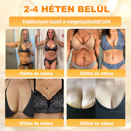🏅 APKAPK® Méhmérges Bőrmegújító Formula – fedezd fel a természetes bőrápolás erejét egy különleges regeneráló krémmel 🌿