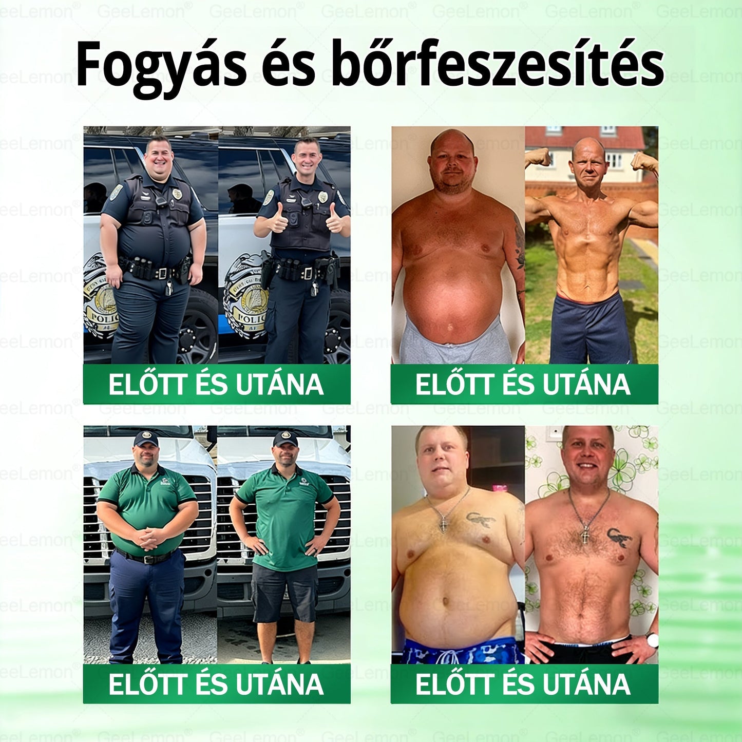 𝐆𝐞𝑒𝐿𝑒𝐦𝐨𝐧® Glumasetide 8 az 1-ben Karcsú és Egészséges Nano Mikrotűs Tapasz 🇭🇺