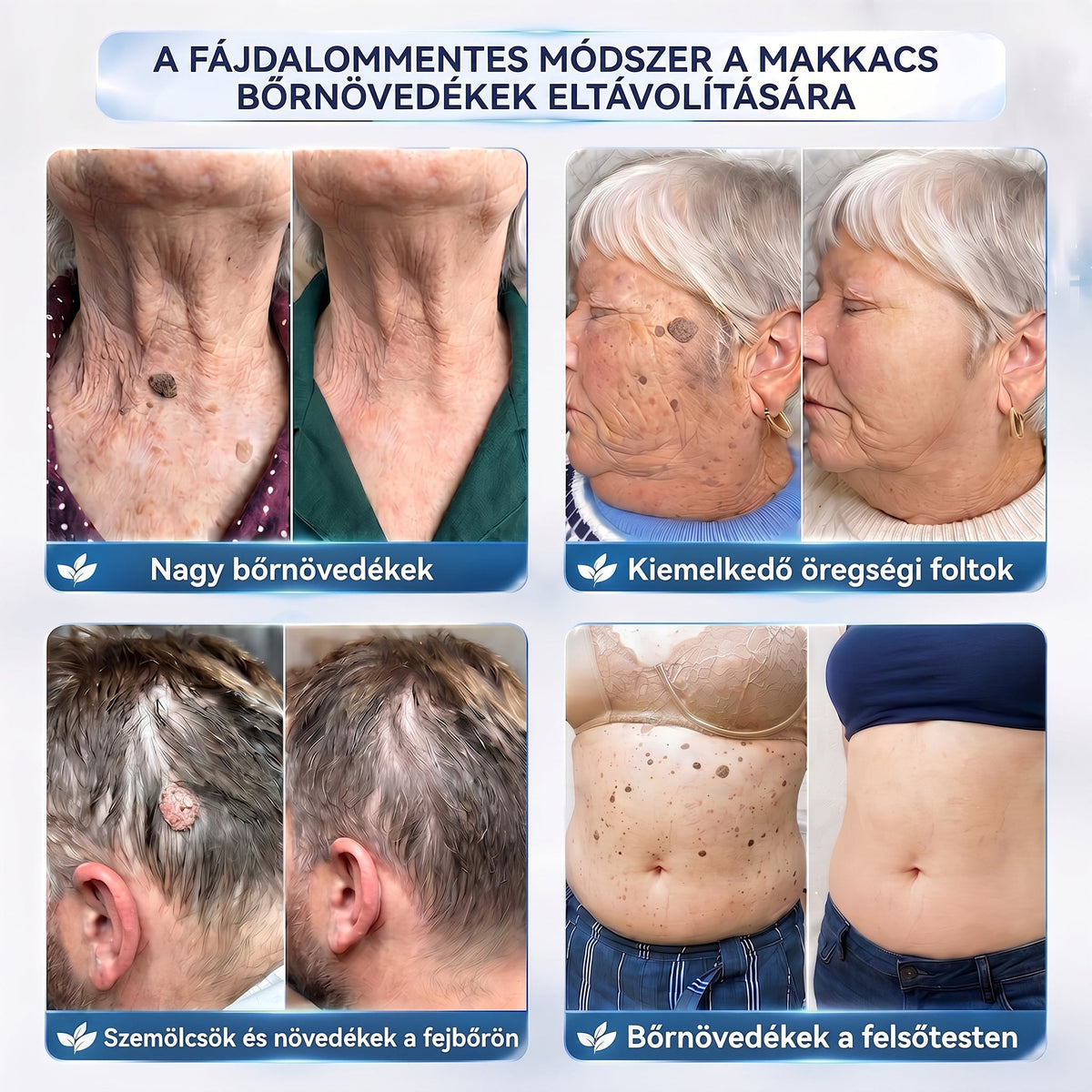 APKAPK® 𝟕 𝐧𝐚𝐩𝐨𝐬 𝐛ő𝐫𝐤𝐢𝐧ö𝐯é𝐬- é𝐬 𝐩𝐢𝐠𝐦𝐞𝐧𝐭𝐟𝐨𝐥𝐭-á𝐩𝐨𝐥ó 𝐤𝐫é𝐦 – 𝐅á𝐣𝐝𝐚𝐥𝐨𝐦𝐦𝐞𝐧𝐭𝐞𝐬 á𝐩𝐨𝐥á𝐬, 𝐬𝐢𝐦á𝐛𝐛 𝐛ő𝐫𝐤é𝐩 ✨