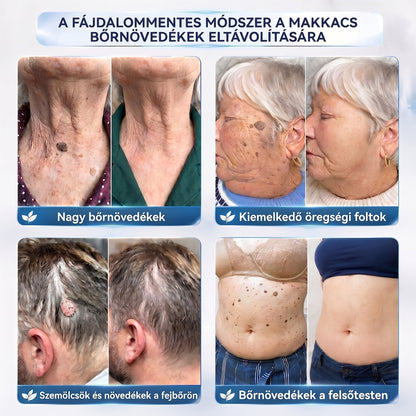 APKAPK® 𝟕 𝐧𝐚𝐩𝐨𝐬 𝐛ő𝐫𝐤𝐢𝐧ö𝐯é𝐬- é𝐬 𝐩𝐢𝐠𝐦𝐞𝐧𝐭𝐟𝐨𝐥𝐭-á𝐩𝐨𝐥ó 𝐤𝐫é𝐦 – 𝐅á𝐣𝐝𝐚𝐥𝐨𝐦𝐦𝐞𝐧𝐭𝐞𝐬 á𝐩𝐨𝐥á𝐬, 𝐬𝐢𝐦á𝐛𝐛 𝐛ő𝐫𝐤é𝐩 ✨