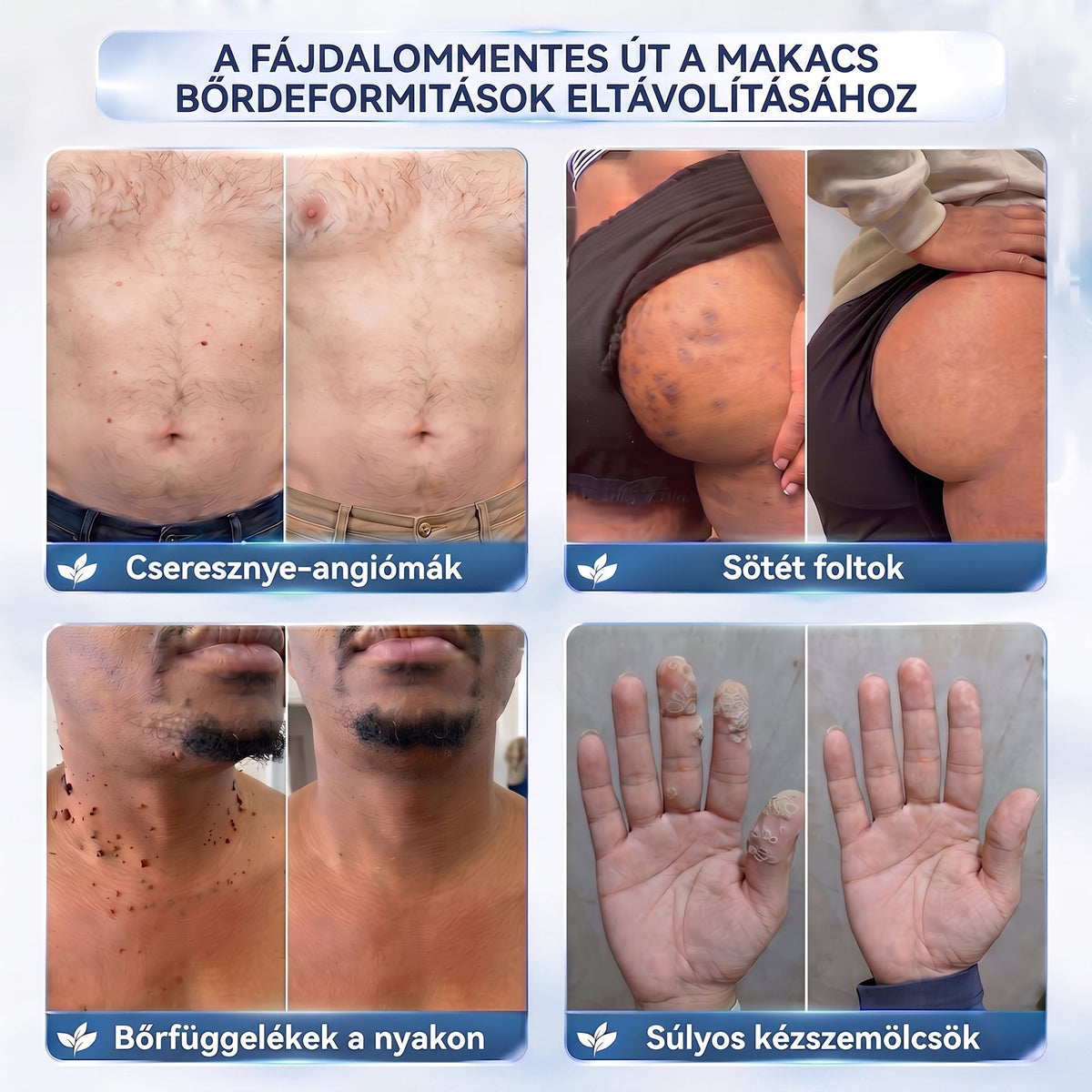 APKAPK® 𝟕 𝐧𝐚𝐩𝐨𝐬 𝐛ő𝐫𝐤𝐢𝐧ö𝐯é𝐬- é𝐬 𝐩𝐢𝐠𝐦𝐞𝐧𝐭𝐟𝐨𝐥𝐭-á𝐩𝐨𝐥ó 𝐤𝐫é𝐦 – 𝐅á𝐣𝐝𝐚𝐥𝐨𝐦𝐦𝐞𝐧𝐭𝐞𝐬 á𝐩𝐨𝐥á𝐬, 𝐬𝐢𝐦á𝐛𝐛 𝐛ő𝐫𝐤é𝐩 ✨