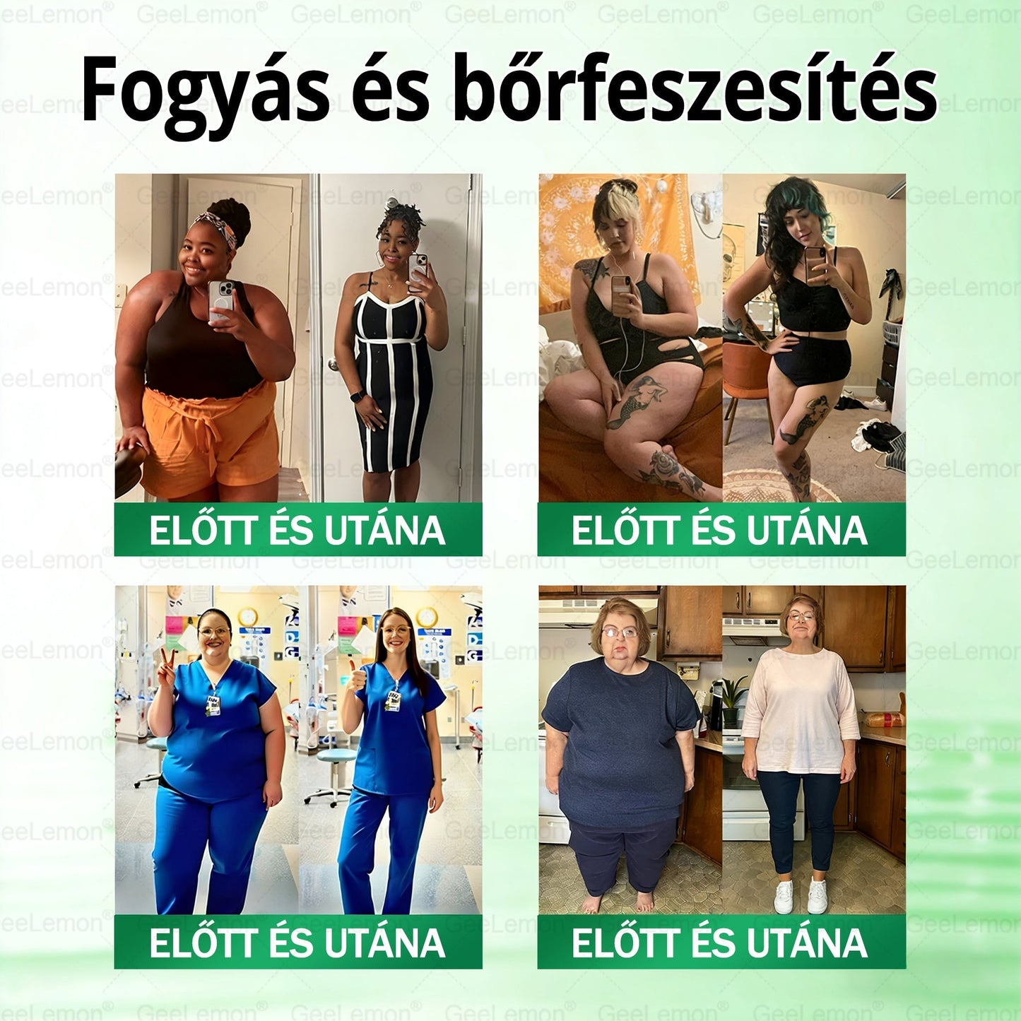 𝐆𝐞𝑒𝐿𝑒𝐦𝐨𝐧® Glumasetide 8 az 1-ben Karcsú és Egészséges Nano Mikrotűs Tapasz 🇭🇺
