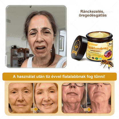 𝐀𝐏𝐊𝐀𝐏𝐊® 𝐌É𝐇𝐌É𝐑𝐄𝐆 Á𝐓𝐅𝐎𝐆Ó 𝐊𝐑É𝐌🥇𝐀 𝐛ö𝐫𝐩𝐫𝐨𝐛𝐥é𝐦á𝐤 𝐤𝐞𝐳𝐞𝐥é𝐬𝐞 𝐦𝐚𝐠á𝐛𝐚𝐧 𝐟𝐨𝐠𝐥𝐚𝐥𝐣𝐚: é𝐥𝐞𝐭𝐤𝐨𝐫𝐢 𝐟𝐨𝐥𝐭𝐨𝐤, 𝐡𝐞𝐠𝐞𝐤, 𝐬𝐳𝐞𝐦ö𝐥𝐜𝐬ö𝐤, 𝐛ö𝐫𝐧ö𝐯𝐞𝐝é𝐤𝐞𝐤, 𝐭á𝐥𝐲𝐨𝐠𝐨𝐤, 𝐩𝐚𝐭𝐭𝐚𝐧á𝐬𝐨𝐤, 𝐞𝐤𝐜é𝐦𝐚, 𝐩𝐬𝐨𝐫𝐢𝐚𝐬𝐢𝐬, 𝐚𝐜𝐧𝐞 𝐢𝐧𝐯𝐞𝐫𝐬𝐚, 𝐫á𝐧𝐜𝐨𝐤, 𝐛ö𝐫ö𝐫𝐞𝐠𝐞𝐝é𝐬 é𝐬 𝐞𝐠𝐲é𝐛 𝐩𝐫𝐨𝐛𝐥é𝐦á𝐤🔥