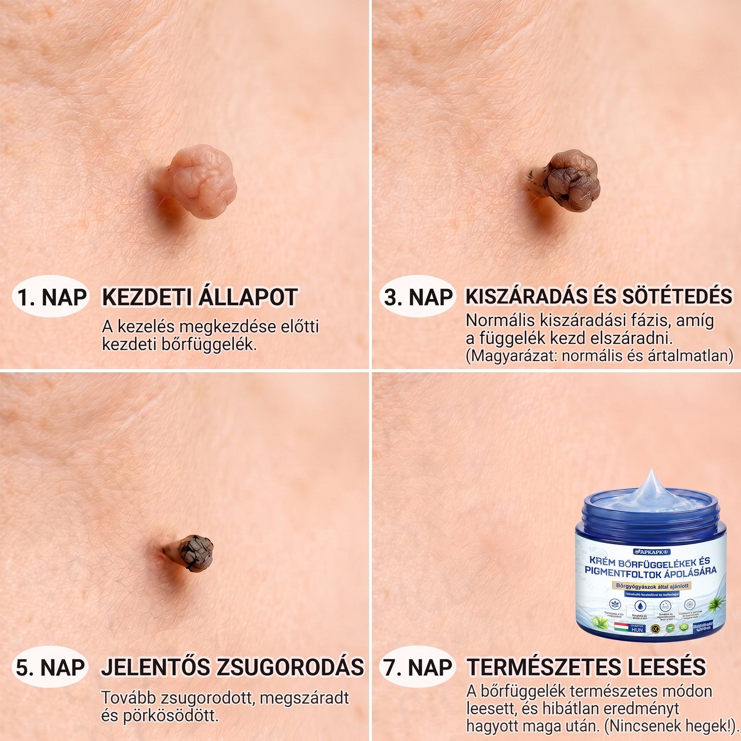APKAPK® 𝟕 𝐧𝐚𝐩𝐨𝐬 𝐛ő𝐫𝐤𝐢𝐧ö𝐯é𝐬- é𝐬 𝐩𝐢𝐠𝐦𝐞𝐧𝐭𝐟𝐨𝐥𝐭-á𝐩𝐨𝐥ó 𝐤𝐫é𝐦 – 𝐅á𝐣𝐝𝐚𝐥𝐨𝐦𝐦𝐞𝐧𝐭𝐞𝐬 á𝐩𝐨𝐥á𝐬, 𝐬𝐢𝐦á𝐛𝐛 𝐛ő𝐫𝐤é𝐩 ✨