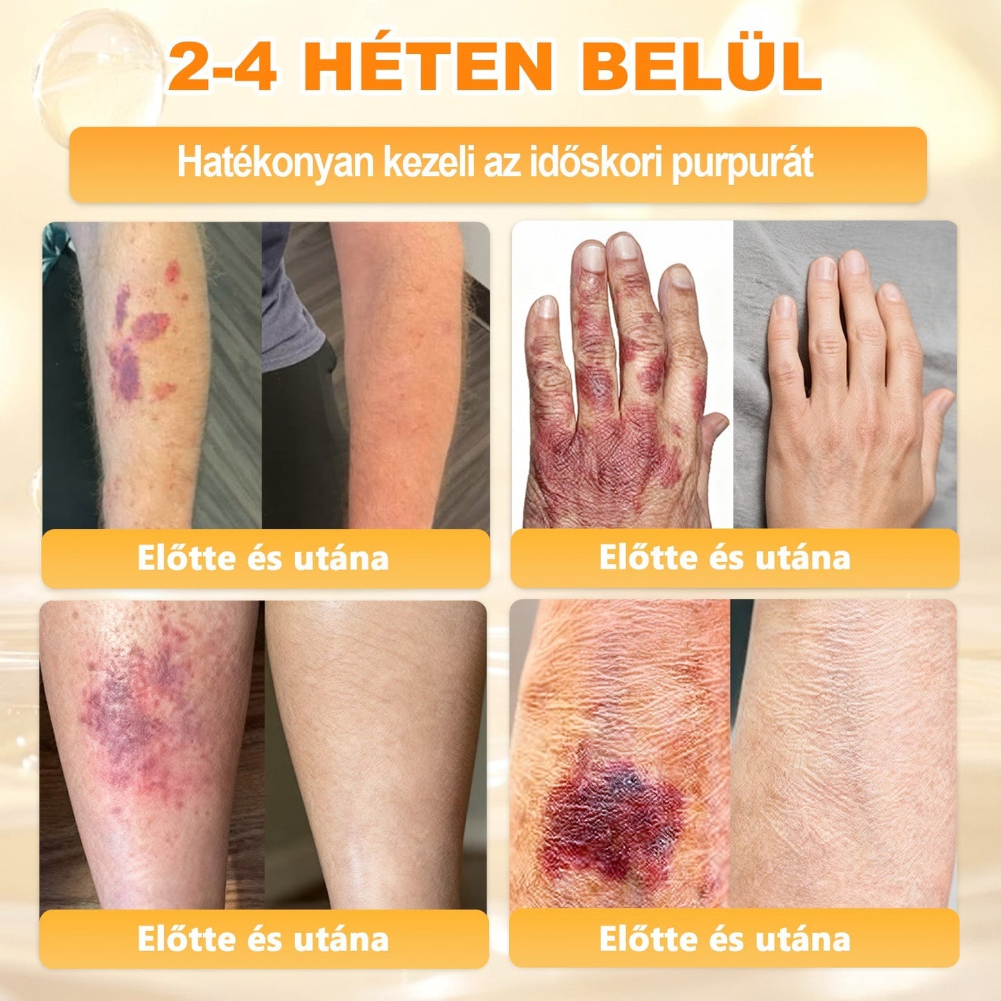 🏅 APKAPK® Méhmérges Bőrmegújító Formula – fedezd fel a természetes bőrápolás erejét egy különleges regeneráló krémmel 🌿