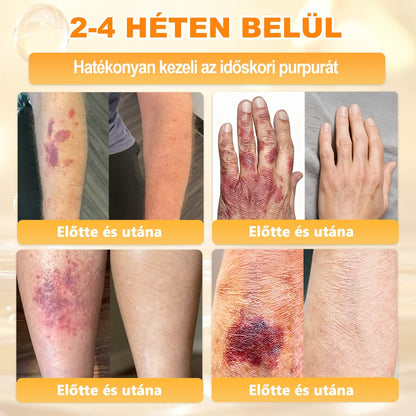 🏅 APKAPK® Méhmérges Bőrmegújító Formula – fedezd fel a természetes bőrápolás erejét egy különleges regeneráló krémmel 🌿