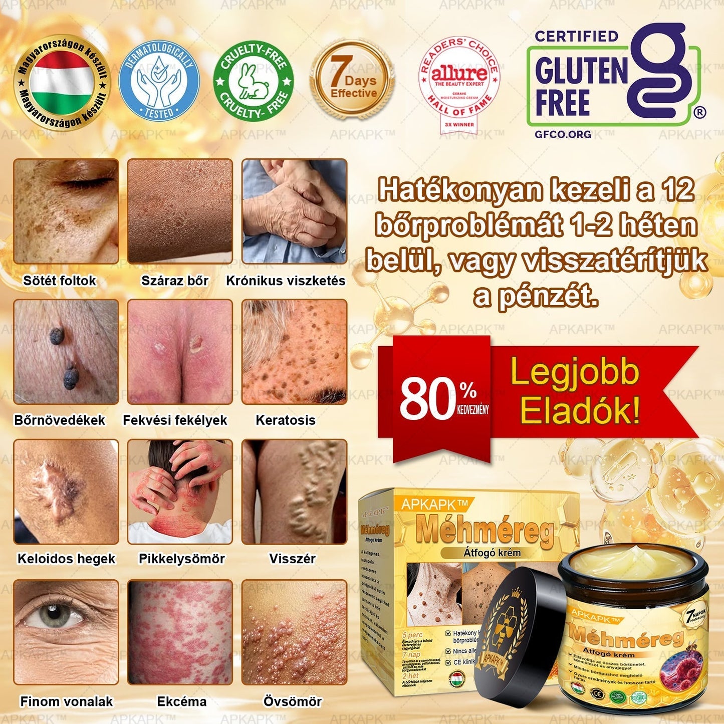 𝐀𝐏𝐊𝐀𝐏𝐊® 𝐌É𝐇𝐌É𝐑𝐄𝐆 Á𝐓𝐅𝐎𝐆Ó 𝐊𝐑É𝐌🥇𝐀 𝐛ö𝐫𝐩𝐫𝐨𝐛𝐥é𝐦á𝐤 𝐤𝐞𝐳𝐞𝐥é𝐬𝐞 𝐦𝐚𝐠á𝐛𝐚𝐧 𝐟𝐨𝐠𝐥𝐚𝐥𝐣𝐚: é𝐥𝐞𝐭𝐤𝐨𝐫𝐢 𝐟𝐨𝐥𝐭𝐨𝐤, 𝐡𝐞𝐠𝐞𝐤, 𝐬𝐳𝐞𝐦ö𝐥𝐜𝐬ö𝐤, 𝐛ö𝐫𝐧ö𝐯𝐞𝐝é𝐤𝐞𝐤, 𝐭á𝐥𝐲𝐨𝐠𝐨𝐤, 𝐩𝐚𝐭𝐭𝐚𝐧á𝐬𝐨𝐤, 𝐞𝐤𝐜é𝐦𝐚, 𝐩𝐬𝐨𝐫𝐢𝐚𝐬𝐢𝐬, 𝐚𝐜𝐧𝐞 𝐢𝐧𝐯𝐞𝐫𝐬𝐚, 𝐫á𝐧𝐜𝐨𝐤, 𝐛ö𝐫ö𝐫𝐞𝐠𝐞𝐝é𝐬 é𝐬 𝐞𝐠𝐲é𝐛 𝐩𝐫𝐨𝐛𝐥é𝐦á𝐤🔥