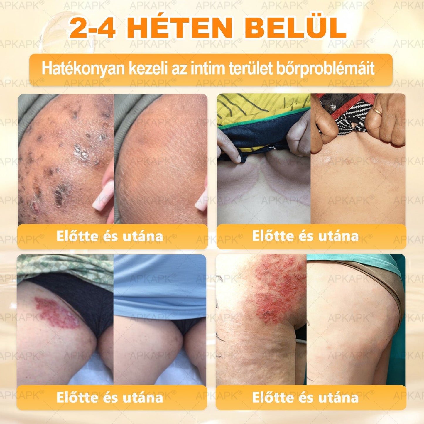 🏅 APKAPK® Méhmérges Bőrmegújító Formula – fedezd fel a természetes bőrápolás erejét egy különleges regeneráló krémmel 🌿