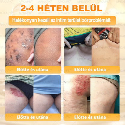 🏅 APKAPK® Méhmérges Bőrmegújító Formula – fedezd fel a természetes bőrápolás erejét egy különleges regeneráló krémmel 🌿