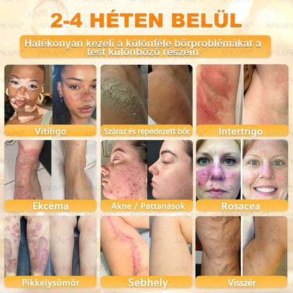🏅 APKAPK® Méhmérges Bőrmegújító Formula – fedezd fel a természetes bőrápolás erejét egy különleges regeneráló krémmel 🌿