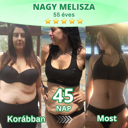 GeeLemon® Moringa + Berberin + NAD+ 15 az 1-ben nanomikrotűs tapasz | A testápolás új generációja fejlett nanoformulával