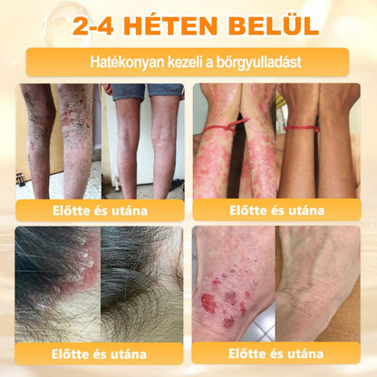 🏅 APKAPK® Méhmérges Bőrmegújító Formula – fedezd fel a természetes bőrápolás erejét egy különleges regeneráló krémmel 🌿