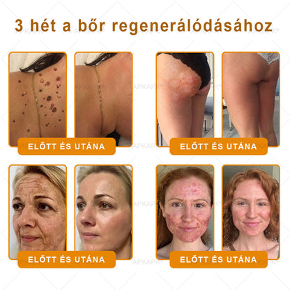 🏅 APKAPK® Méhmérges Bőrmegújító Formula – fedezd fel a természetes bőrápolás erejét egy különleges regeneráló krémmel 🌿