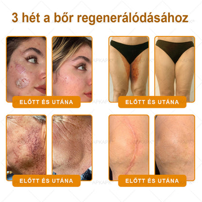🏅 APKAPK® Méhmérges Bőrmegújító Formula – fedezd fel a természetes bőrápolás erejét egy különleges regeneráló krémmel 🌿
