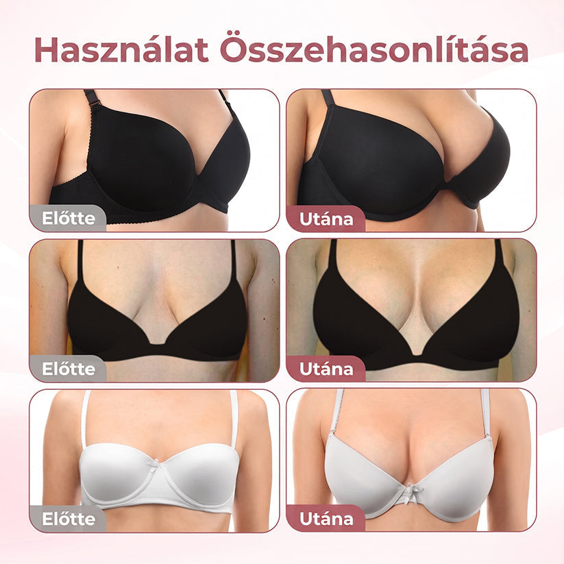 🥇HISKIN® MELLEMELŐ ÉS FESZESÍTŐ MIKROTŰS TAPASZOK