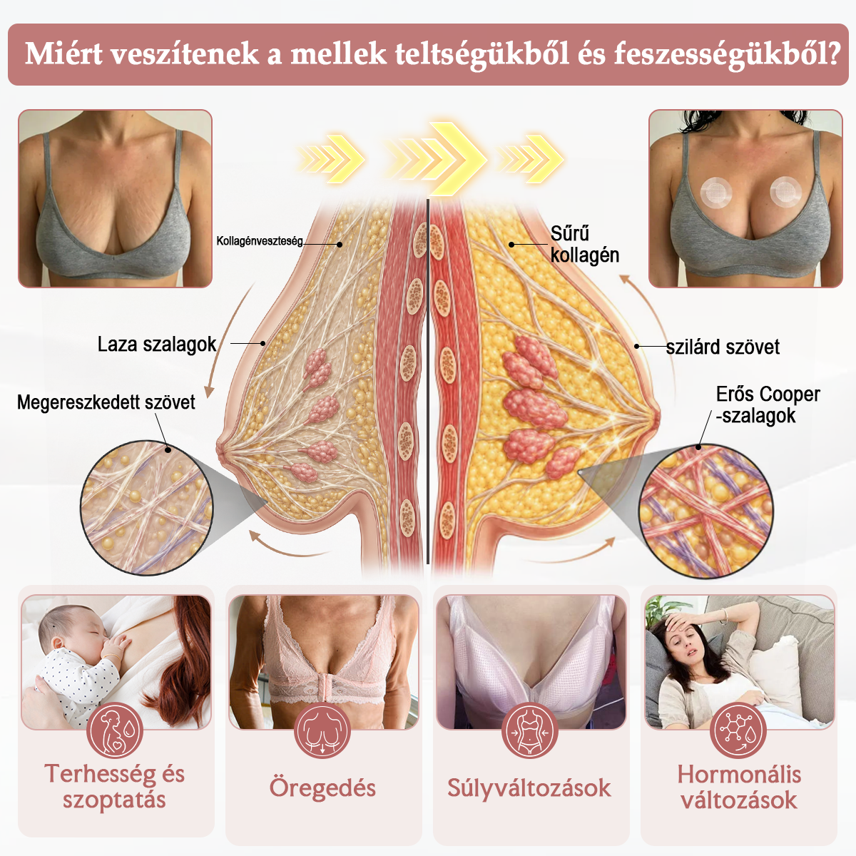 🥇HISKIN® MELLEMELŐ ÉS FESZESÍTŐ MIKROTŰS TAPASZOK