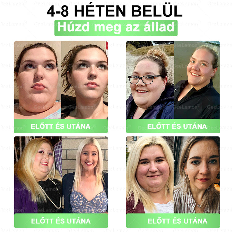 𝐆𝐞𝑒𝐿𝑒𝐦𝐨𝐧® Glumasetide 8 az 1-ben Karcsú és Egészséges Nano Mikrotűs Tapasz 🇭🇺