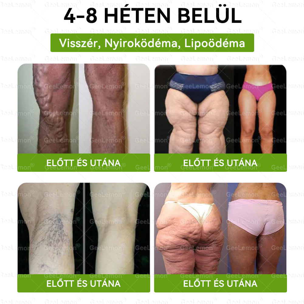 𝐆𝐞𝑒𝐿𝑒𝐦𝐨𝐧® Glumasetide 8 az 1-ben Karcsú és Egészséges Nano Mikrotűs Tapasz 🇭🇺