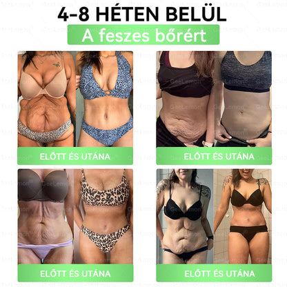 𝐆𝐞𝑒𝐿𝑒𝐦𝐨𝐧® Glumasetide 8 az 1-ben Karcsú és Egészséges Nano Mikrotűs Tapasz 🇭🇺
