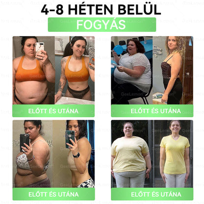 𝐆𝐞𝑒𝐿𝑒𝐦𝐨𝐧® Glumasetide 8 az 1-ben Karcsú és Egészséges Nano Mikrotűs Tapasz 🇭🇺