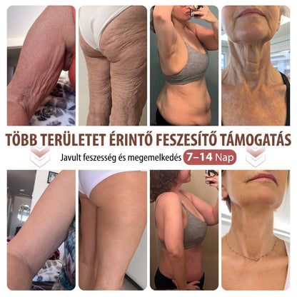 🥇HISKIN® MELLEMELŐ ÉS FESZESÍTŐ MIKROTŰS TAPASZOK